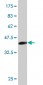 SNAI2 Antibody (monoclonal) (M01)